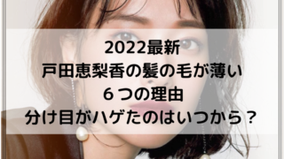 2022最新｜戸田恵梨香の髪の毛が薄い６つの理由！分け目がハゲたのはいつから？