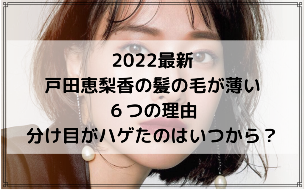 2022最新｜戸田恵梨香の髪の毛が薄い６つの理由！分け目がハゲたのはいつから？