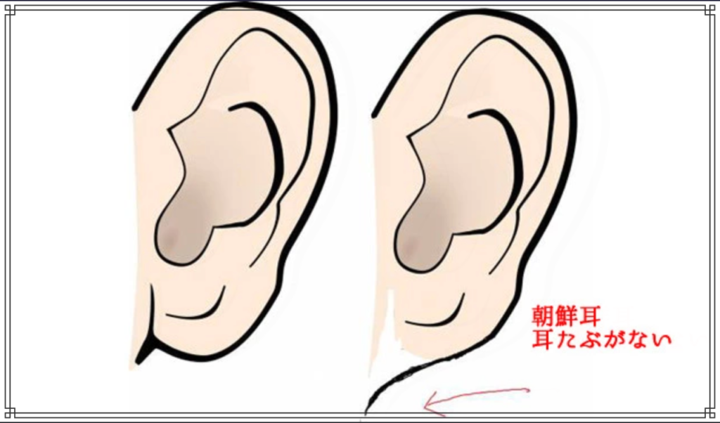 朝鮮耳のイメージ図
