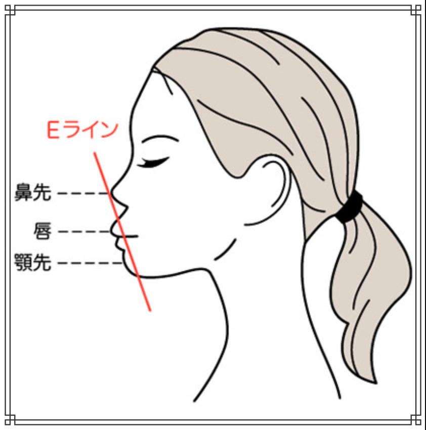 口ゴボのイメージ図